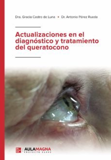 actualizaciones en el diagnostico y tratamiento del queratocono (ebook)-9788418392405
