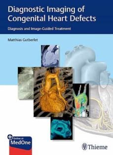 diagnostic imaging of congenital heart defects. diagnosis and image-guided treatment-b ingmar gutberlet-9783132402515