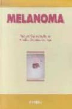 melanoma-9788445807415