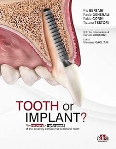 tooth or implant? the recovery or replacement of the severely compromised natural tooth-9781957260525