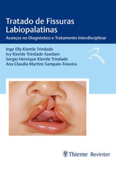 tratado de fissuras labiopalatinas (ebook)-inge elly kiemle trindade-ivy kiemle trindade-suedam-sergio henrique kiemle trindade-9786555722925