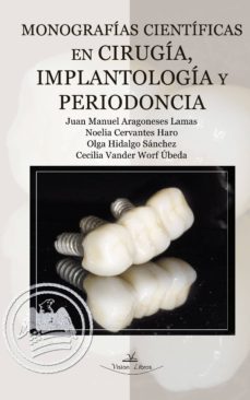 monografias cientificasen cirugia, implantologia y periodoncia (ebook)-9788490111925