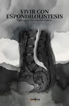 vivir con espondilolistesis-esmeralda hernandez valera-9791387773625