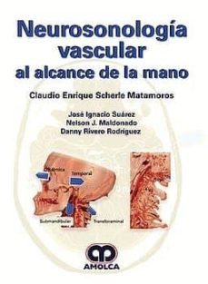 neurosonologia vascular-9789585426535