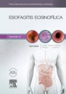 esofagitis eosinofilica: clinicas iberoamericanas de gastroenterologia y hepatologia-j. molina infante-9788490229545