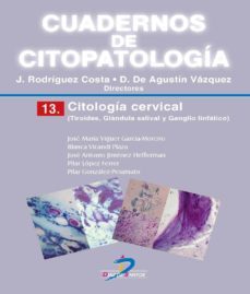 citologia cervical. tiroides, glandula salival y ganglio linfatico (ebook)-julio rodriguez costa-agustin vazquez-9788490521045