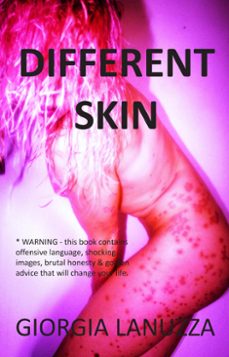 different skin (ebook)-9781915229755