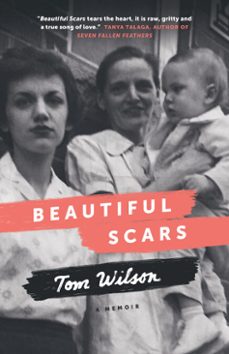 beautiful scars (ebook)-tom wilson-9780385685665