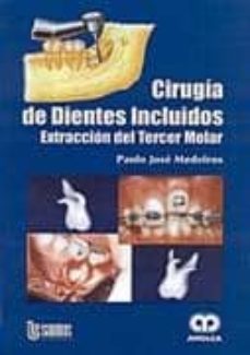 cirugia de dientes incluidos: extraccion del tercer molar-paulo jose medeiros-9789806574465