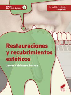 restauraciones y recubrimientos esteticos (2ªed. rev. y ampl.)-javier calderero suarez-9788490772775