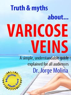 truth &amp; myths about... varicose veins (ebook)-jorge molina-9781310268885