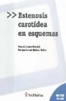 estenosis carotidea en esquemas-pascual lozano vilardell-9788497513685