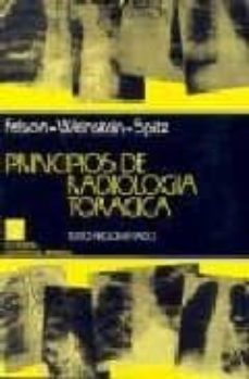 Libros gratis descargas de cd PRINCIPIOS DE RADIOLOGIA TORACICA