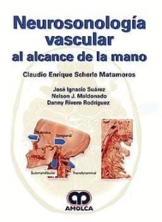 Descarga de libros de audio gratis para mp3 NEUROSONOLOGIA VASCULAR 9789585426535 (Spanish Edition) de C. - SUÁREZ, J. - MALDONADO, N. - RIVERO, D. SCHERLE