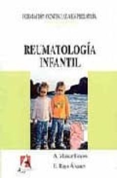 Descargar e book desde google REUMATOLOGIA INFANTIL (Spanish Edition)