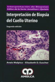 Bestseller descargar ebooks INTERPRETACION DE BIOPSIA DEL CUELLO UTERINO (2ª ED.) 9789588950075
