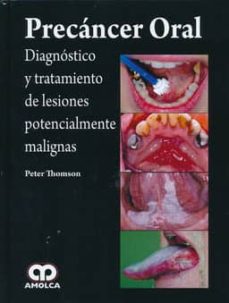 Descargar pdf gratis ebooks PRECANCER ORAL: DIAGNOSTICO Y TRATAMIENTO DE LESIONES POTENCIALES MALIGNAS