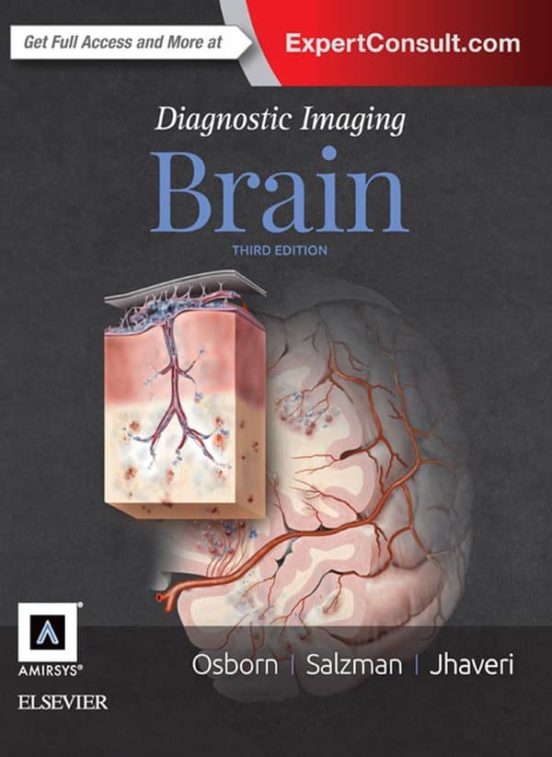 Ebook DIAGNOSTIC IMAGING BRAIN EBOOK EBOOK de ANNE G. OSBORN Casa